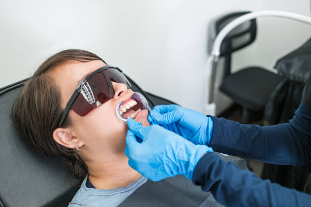 Best Knocked-Out Tooth (Avulsed Tooth) Treatment in New Haven, MO